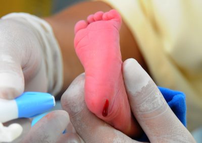 Maternidade Mariana Bulhões agiliza exame do teste do pezinho em ação na próxima terça-feira (6)